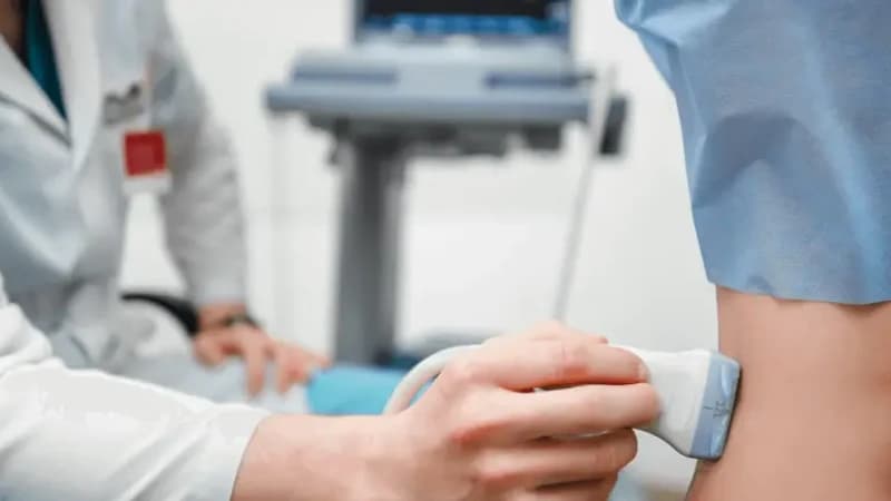 Doppler ven okončin