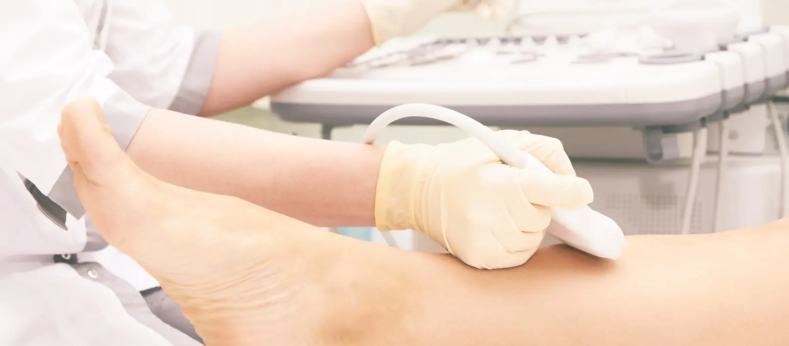 Doppler ultrasound examination of leg veins at Ultrazdravje clinic